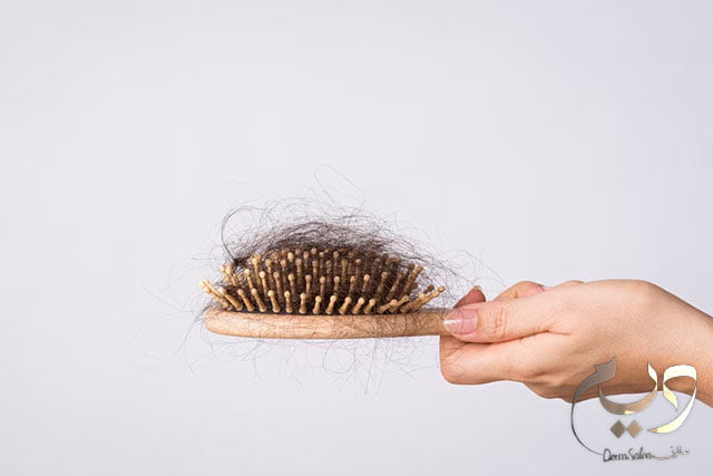 علاج تساقط الشعر وأسباب تساقطه