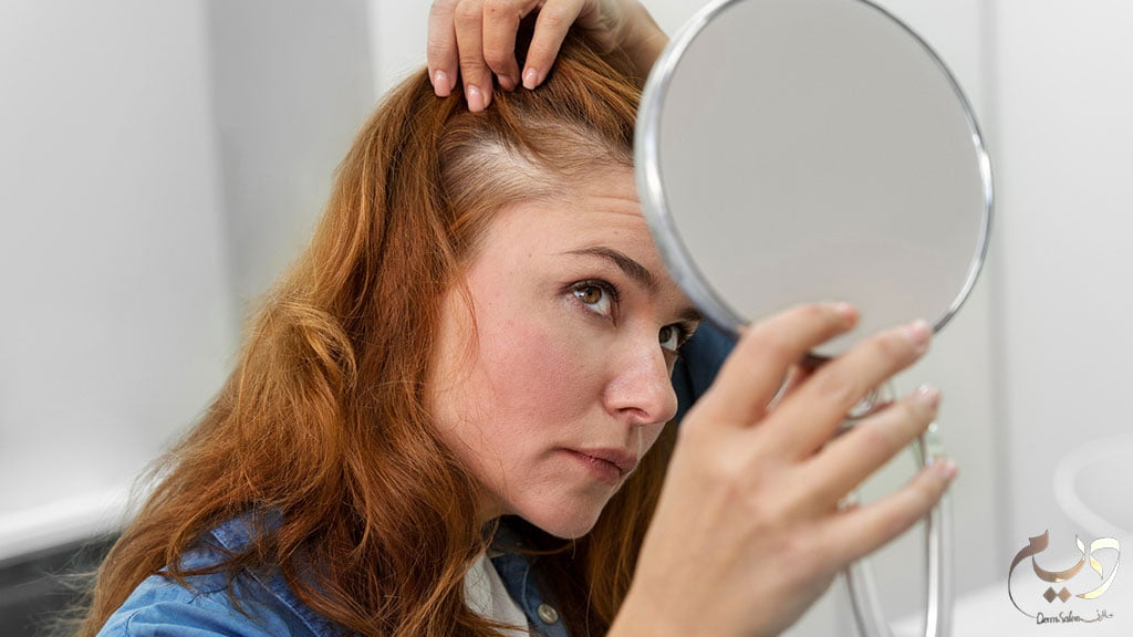 علاج فروة الرأس الجافة. 11 علاج طبيعي يمكن تجربته في المنزل
