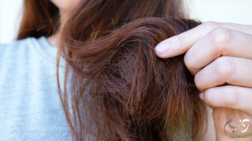 علامات تلف الشعر.. كيف تعرفين شعرك تالف؟